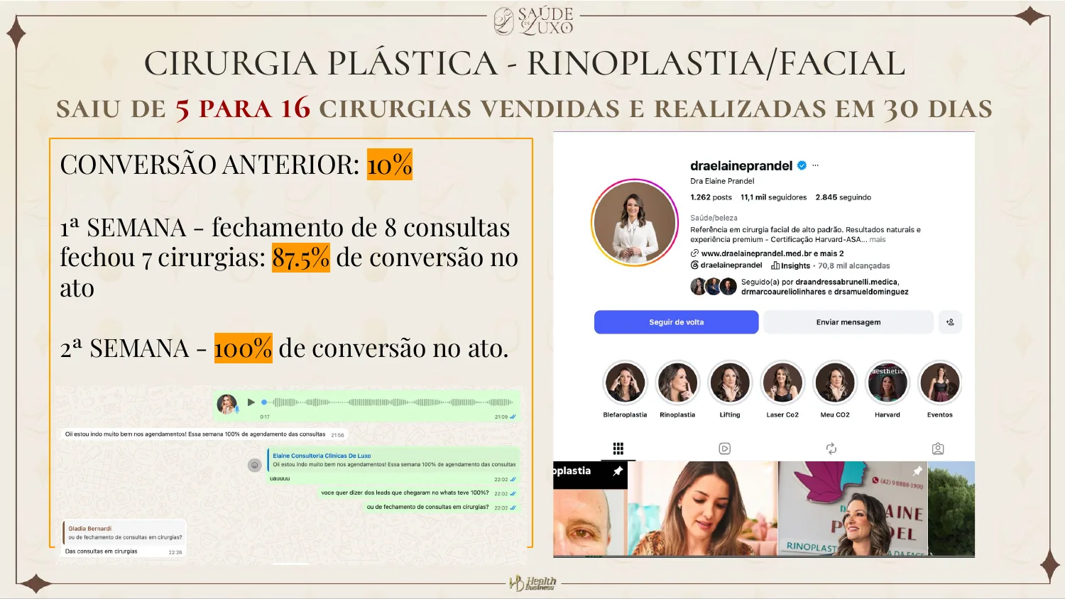 Cirurgia plástica de rinoplastia e facial: saiu de 5 para 16 cirurgias vendidas e realizadas em 30 dias